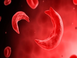 New Therapy May Offer 'Functional Cure' for Two Blood Disorders